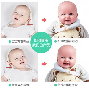 婴儿u型护颈枕宝宝歪脖子矫正斜颈枕头儿童安全座椅定型枕汽车用