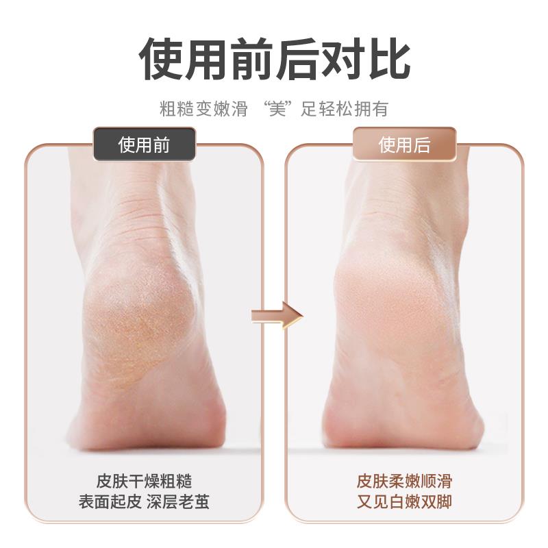 希际电动修脚器磨脚器女士脚后跟去死皮老茧去脚皮家用去角质磨皮