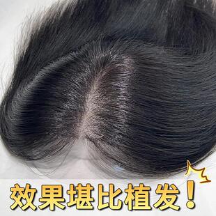 【仿肤递针前额无边】头顶假发片高颅顶全真发女自然前额补发增发