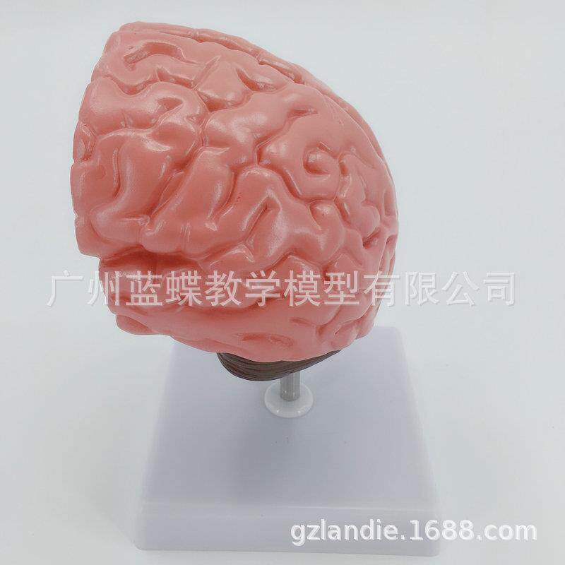 人体大脑解剖 脑/中风模型 脑部疾病模型 脑淤血 脑病变解剖模型