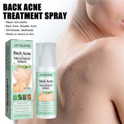 Body Back Chest Acne Treatment Serum Spray Redness Calm 喷雾