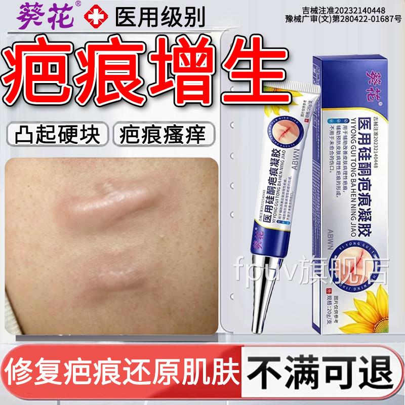 修去增生疤痕凸起硬肉除疤名医用祛疤复膏止痒软化硅酮凝胶贴FPUV
