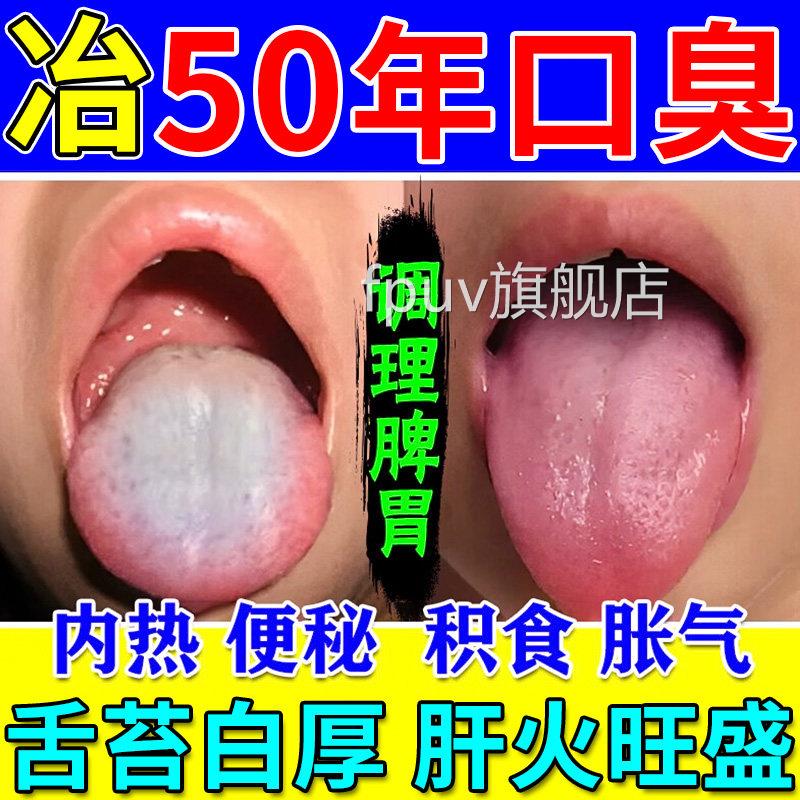 口苦口臭清新贴口臭丸古韵清肚脐贴保健贴便秘口气口调干理脾胃FP