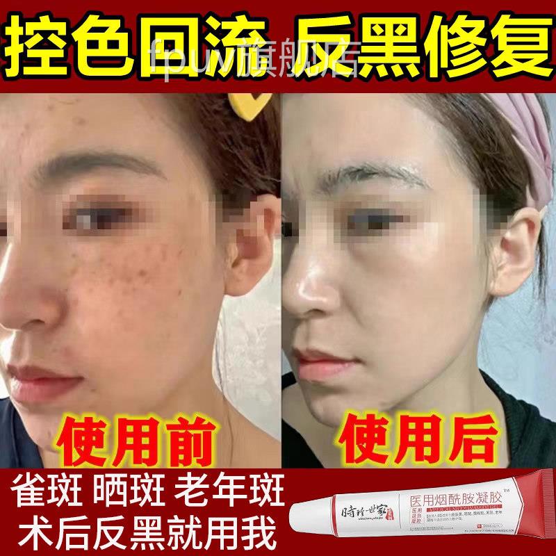 脸上激光反祛斑后黑修复产品黑斑去除分解黑色素沉淀疤痕去黑印TT