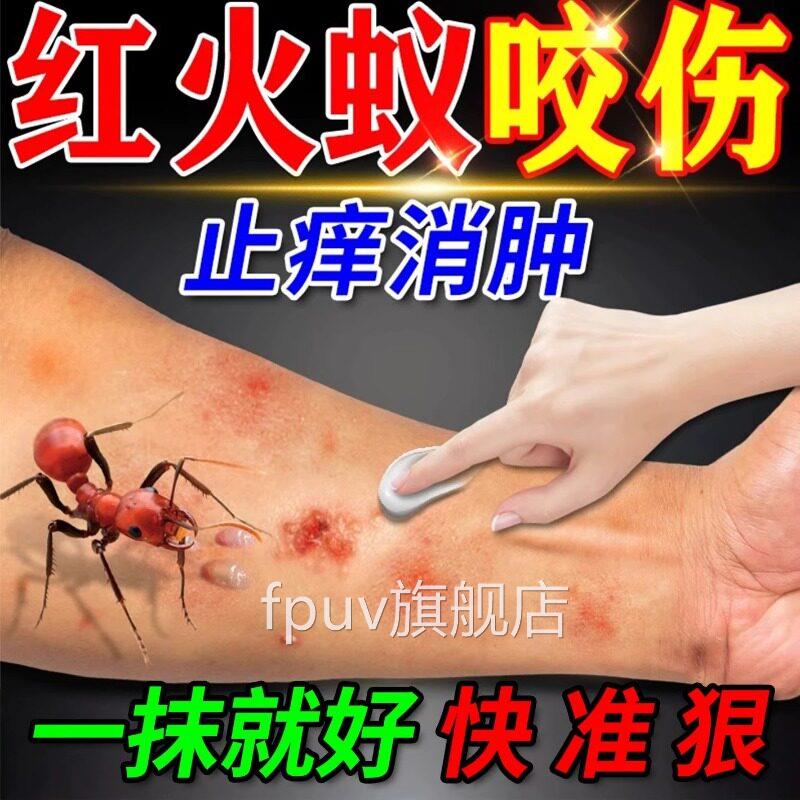 红火蚁叮咬止痒消肿克专用星被蚂同蚁咬伤了擦什么药房款膏外用FP