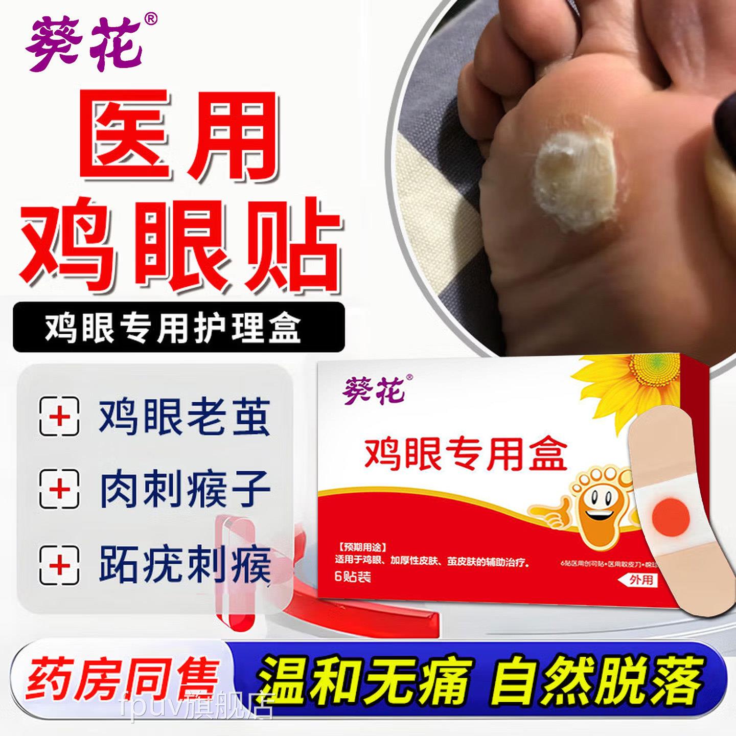脚鸡眼贴专用医用级软膏去无痛厚茧除根水杨根酸官方旗舰店正品FP