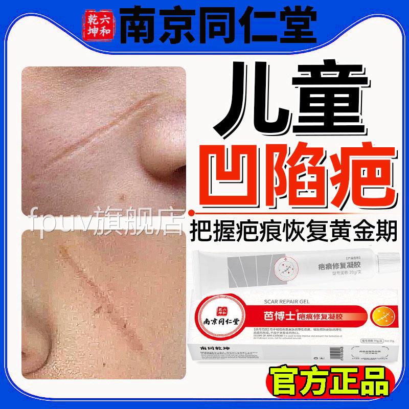 儿童擦伤摔伤凹陷性疤修复手术抓伤除疤膏去黑色素沉痕旗舰店LFPU