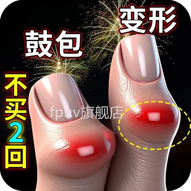 手用指骨关节炎专膏药变形肿大僵硬疼理疗热敷内风湿类关节痛贴膏