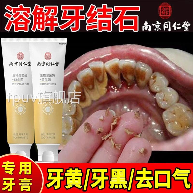 牙膏牙龈出血美白去臭黄去口抗敏正品牙结石专溶解牙石去除器FPUV