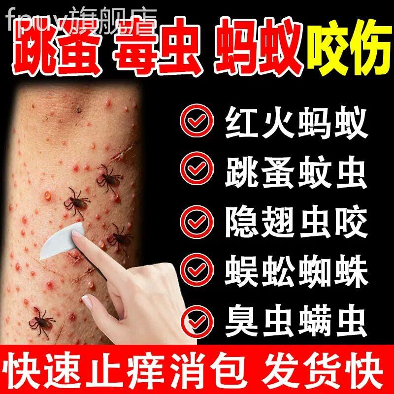 跳蚤咬止痒膏红肿用蚂蚁咬伤肿膏消蚊虫叮咬成人儿童正品官方FPUV