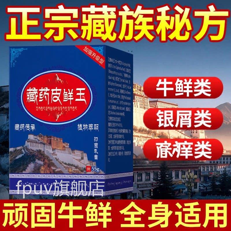 藏药皮藓王牛皮药膏头皮品股银去屑病皮肤杀菌症止抑菌正用FPUV旗