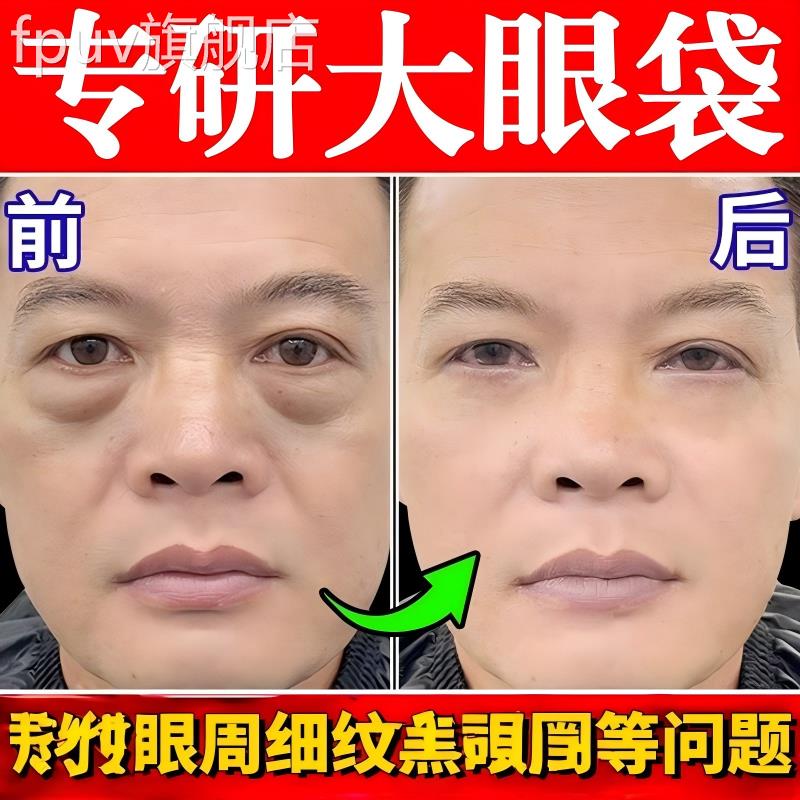 眼袋排肿膏消液严重肿强力去眼克消除袋神男士器一分钟专用霜星FP