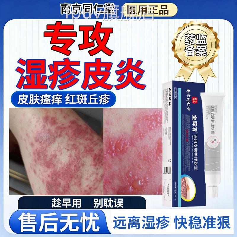 皮炎瘙痒湿止痒膏抗菌消炎角化型湿专除湿止痒皮肤用护理软膏FPUV