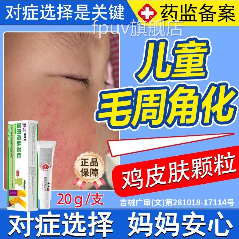 葵花毛周角同化症儿童小颗粒去除专鸡皮肤脸上毛囊角化药房售FPUV
