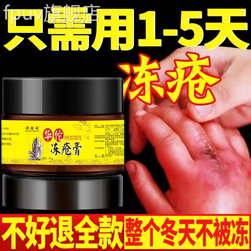 冻疮膏痒冻伤膏消止防冻防裂肿修复手足耳朵脸老牌子正品儿童成人