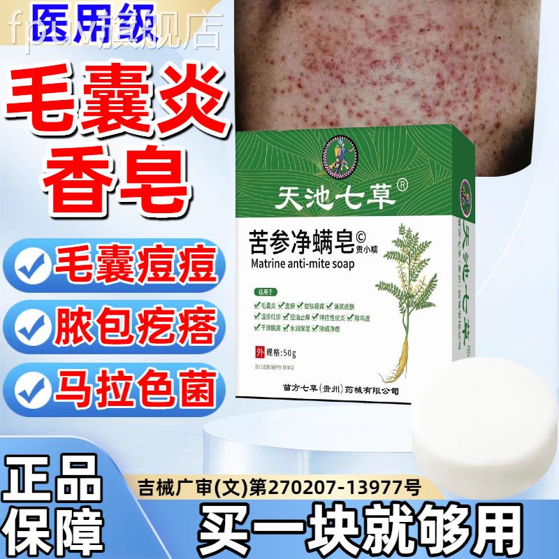 背上后背长痘痘除螨马拉色菌药硫磺皂膏祛痘痒毛囊炎疼沐浴香皂ww