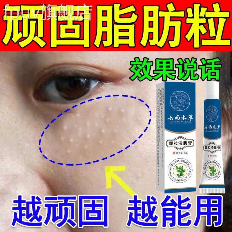 云南草颗粒清肌膏官方旗舰店男女本通用眼周脂肪去除粒神器正品FP