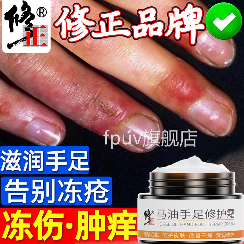冻疮膏止痒裂冻伤膏正品儿童防裂口干冻手耳朵消肿防冻马油修复霜