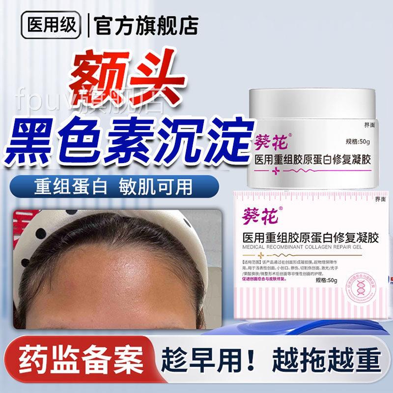 头黑色素沉淀沉着去除淡化脸部脸上黑斑祛痘印疤印分解黑色额素UU