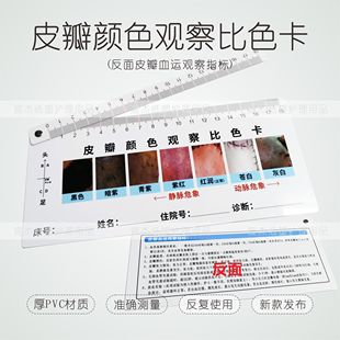 皮瓣颜色观察比色卡医用植皮手术测量尺动脉静脉血运危象观测现货