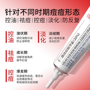 喜辽妥20%壬二酸祛痘精华霜祛痘印修复淡化痘印黑头水杨酸任二酸