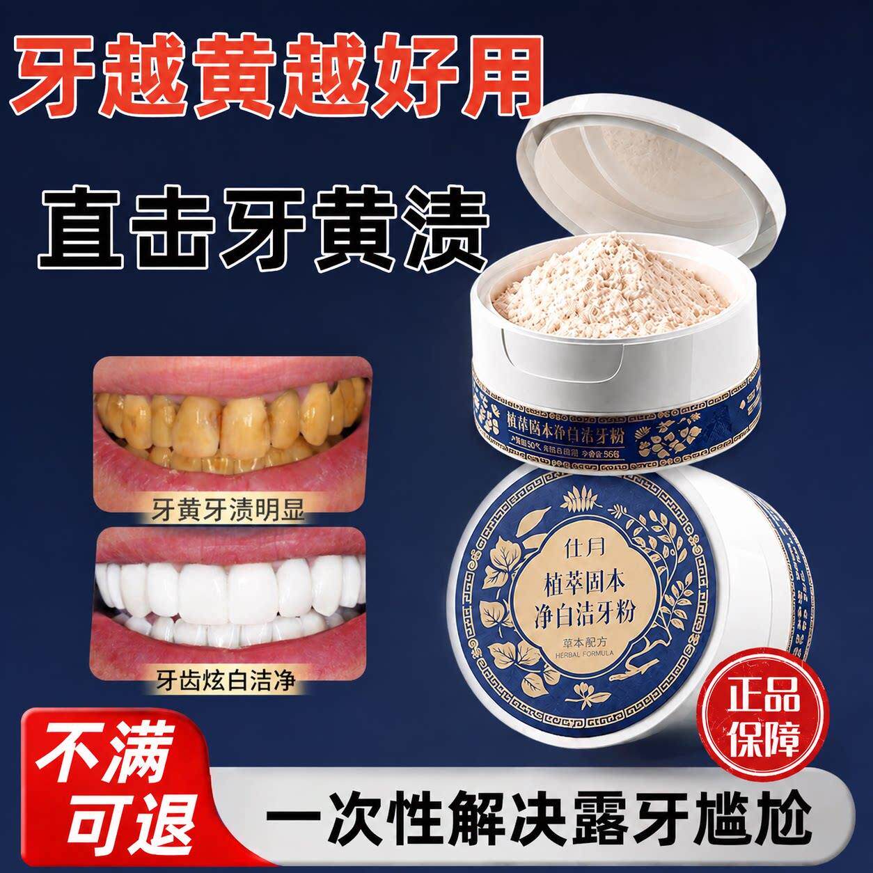洁牙粉去牙黄洗白去渍烟渍护龈牙白牙渍结石牙垢去口臭污垢洗神器