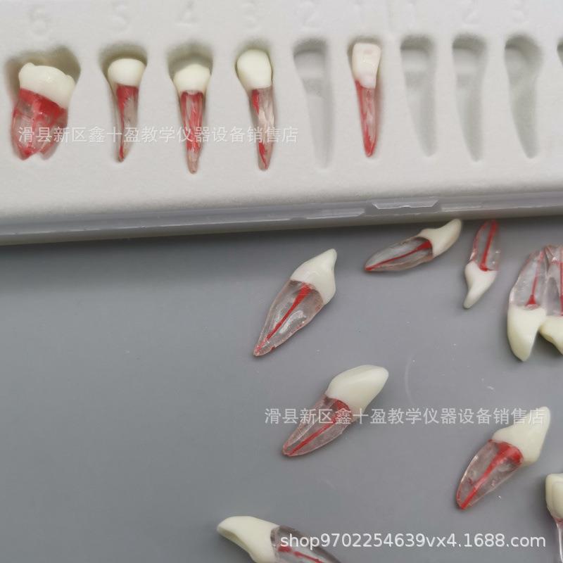全口28颗离体牙模型 带牙根 红根管牙 破冠开髓扩大疏通根充练习