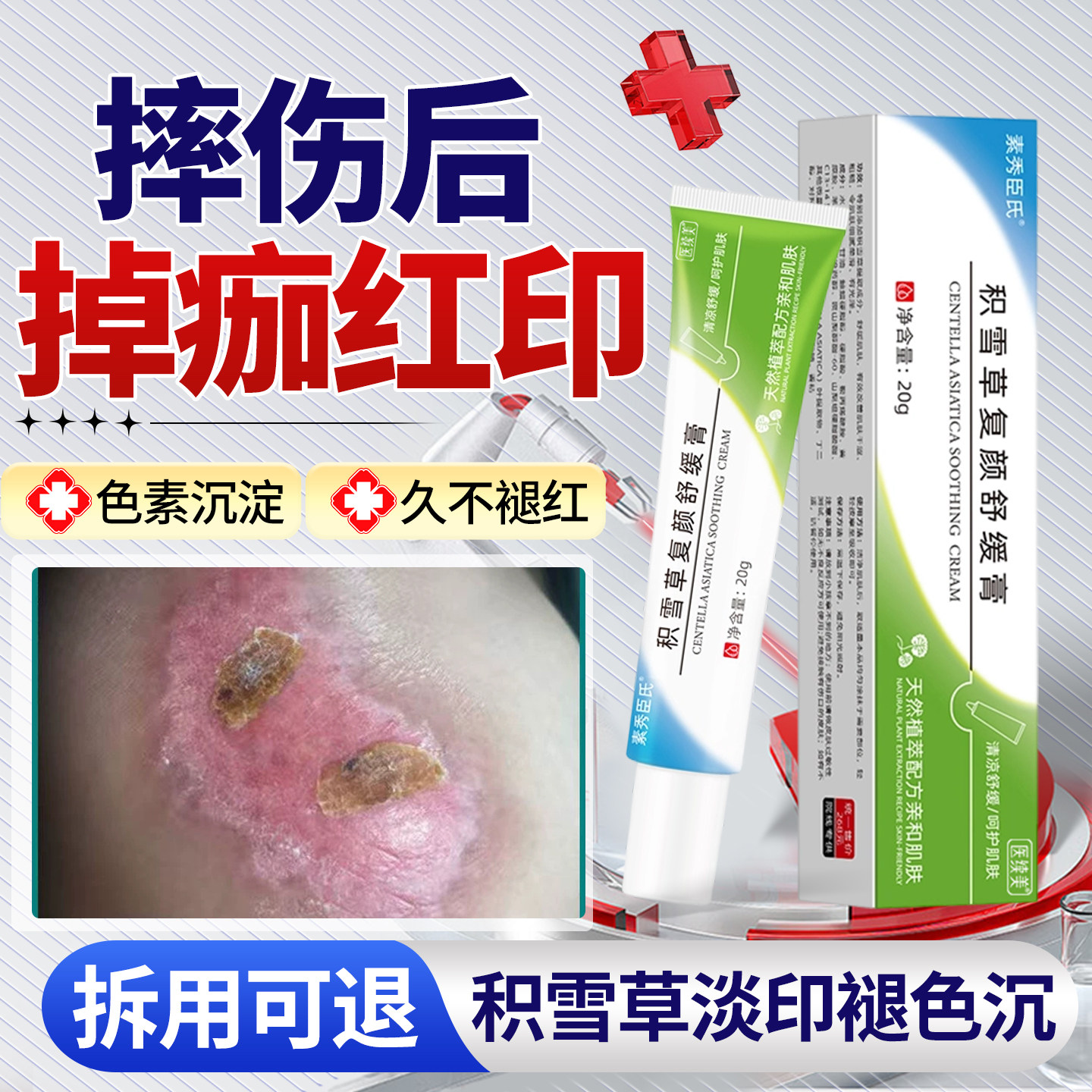 摔伤后掉痂红印【积雪草】图片