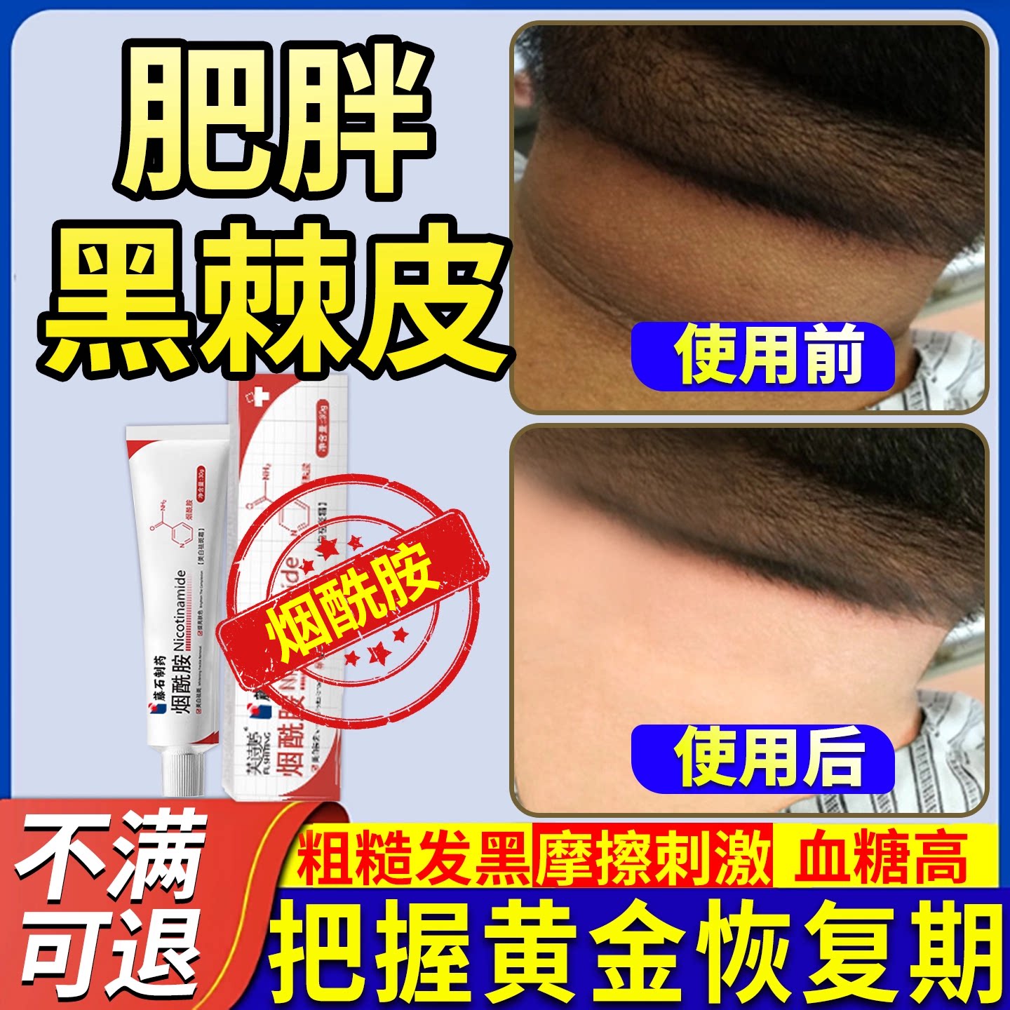 【肥胖黑棘皮】正品保障