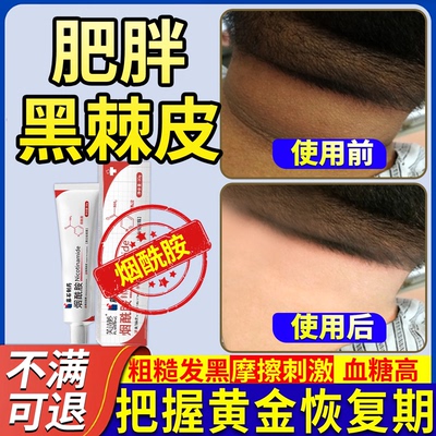 【肥胖黑棘皮】正品保障