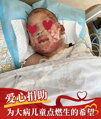 【捐款公益】大病儿童救助行动   慈善募捐 日行一善  点亮爱心