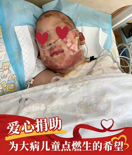 【捐款公益】大病儿童救助行慈善善募捐日一点亮爱心