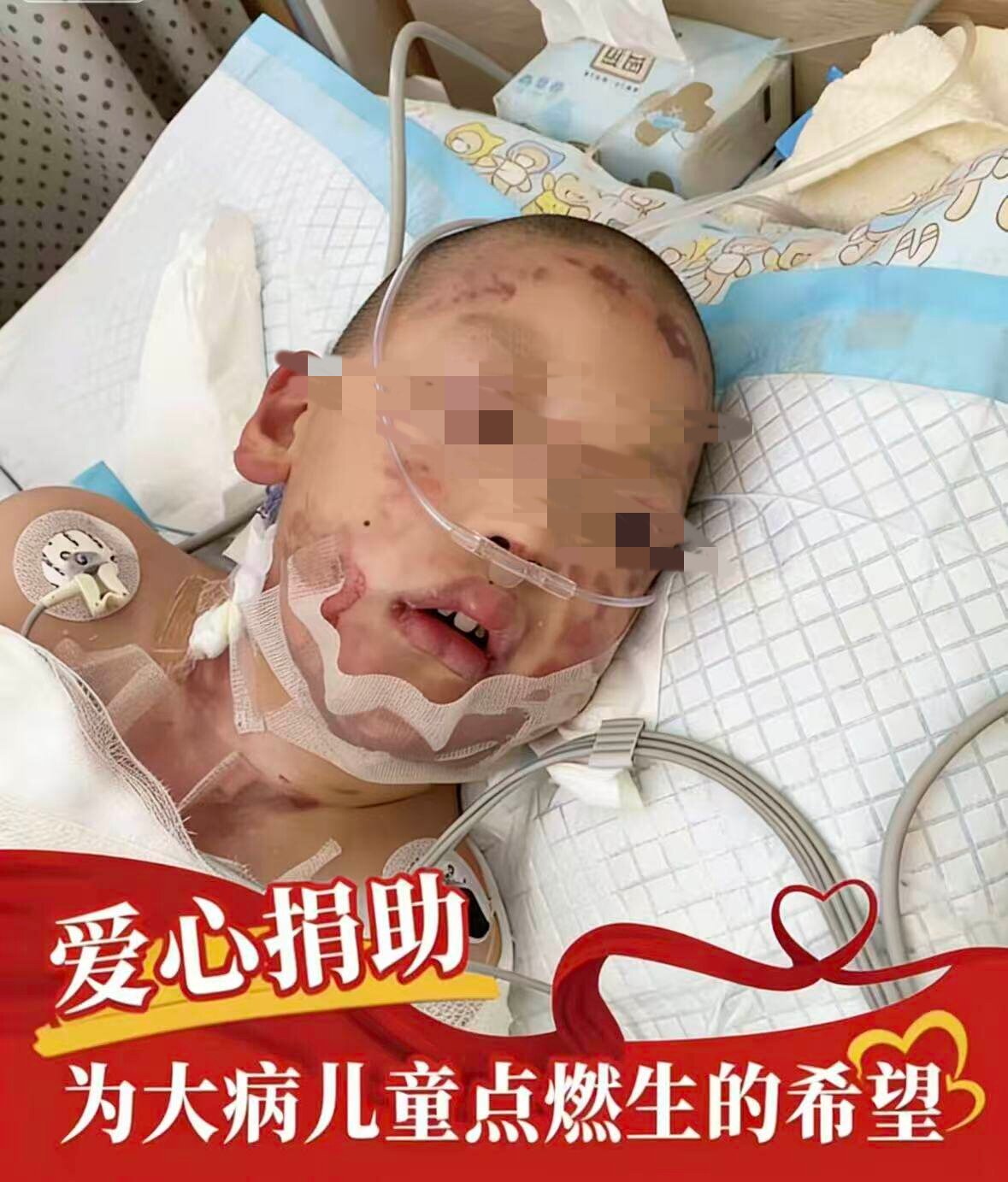 【慈善捐款】为大病儿童点燃生的希望  慈善募捐爱心公益捐助