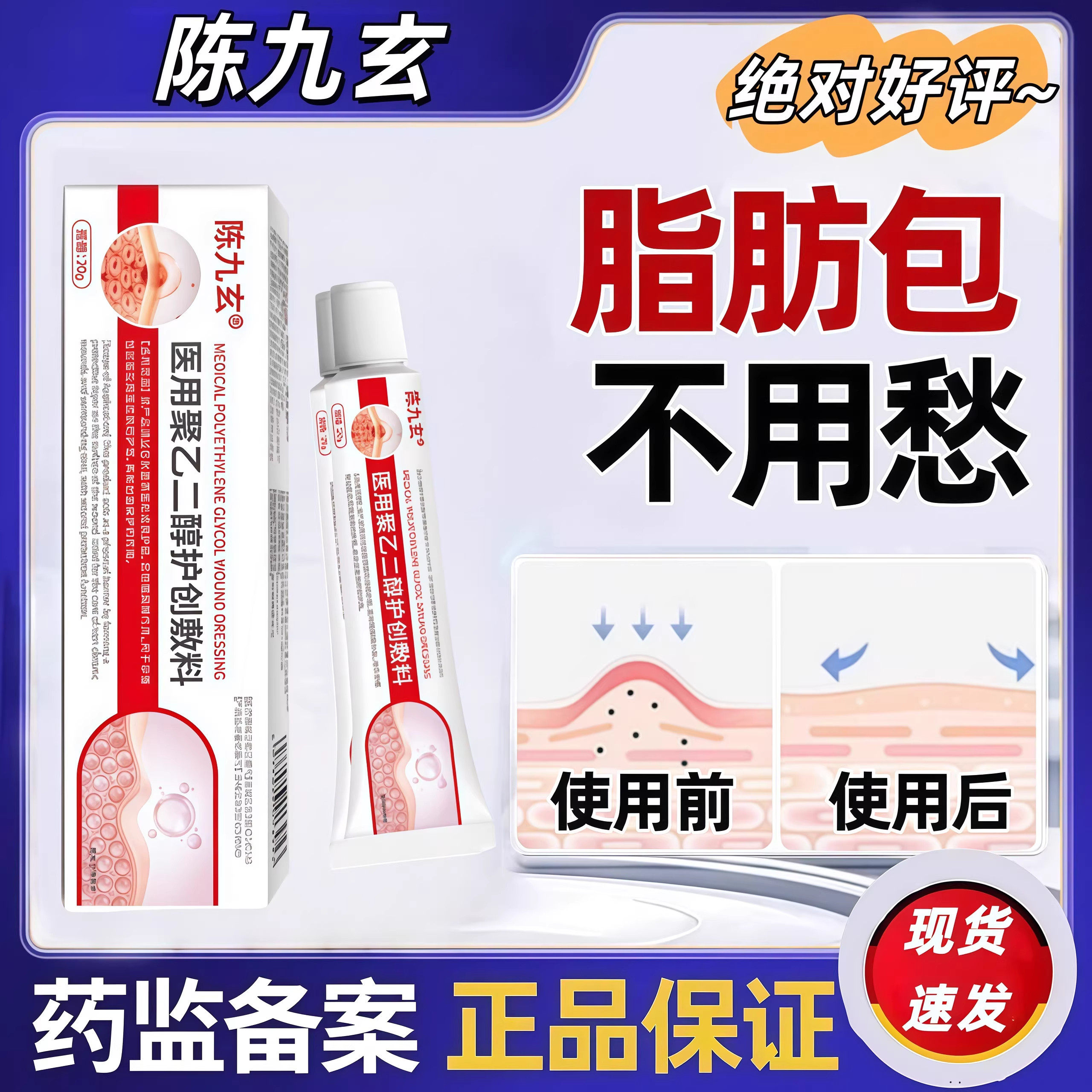 陈九玄医用聚乙二醇护创敷料