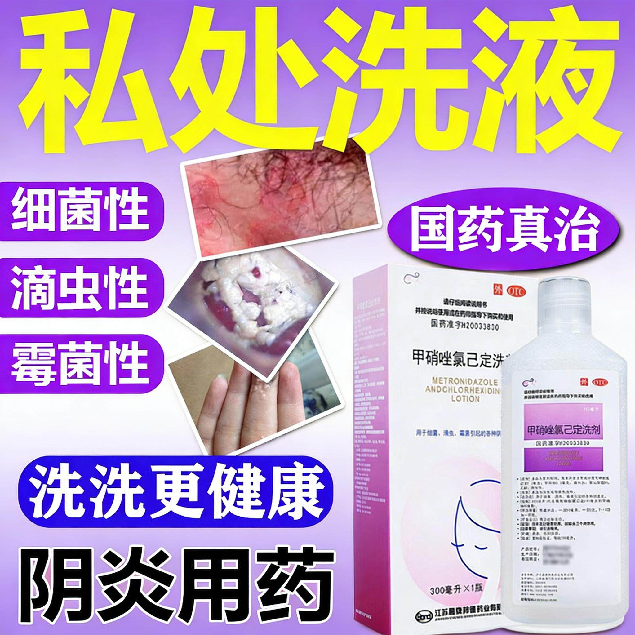 妇科洗液止痒杀菌炎症阴道炎用药女人私处清洗液甲硝唑氯己定洗剂