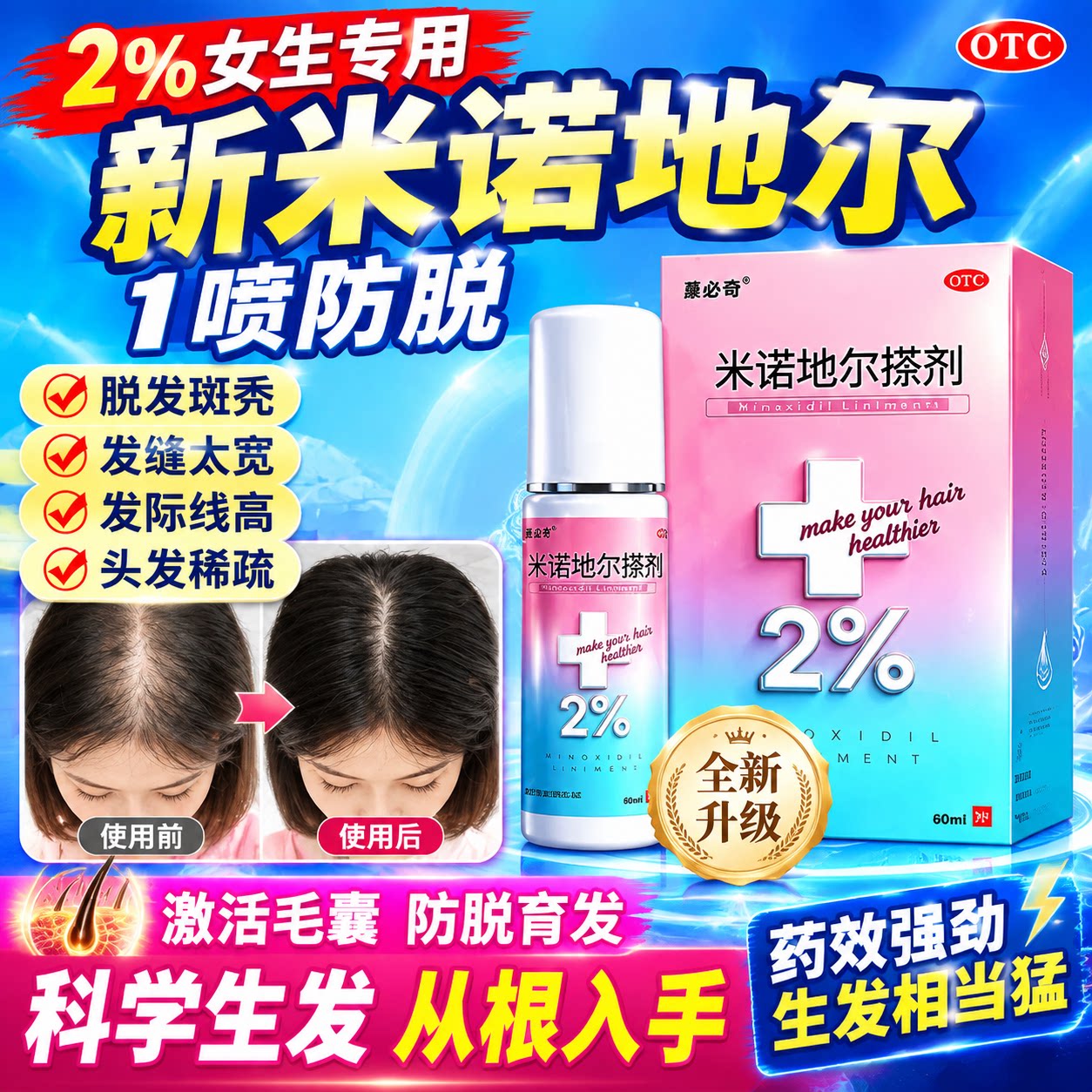 米诺地尔搽剂女士2%生发液官方旗舰店男士掉头发防脱育发医用级