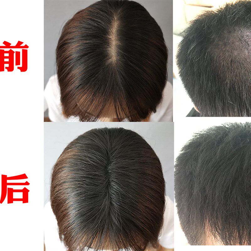顶速密27.5美发粉男女增发补发视觉美发纤维假发应急快速填补密发