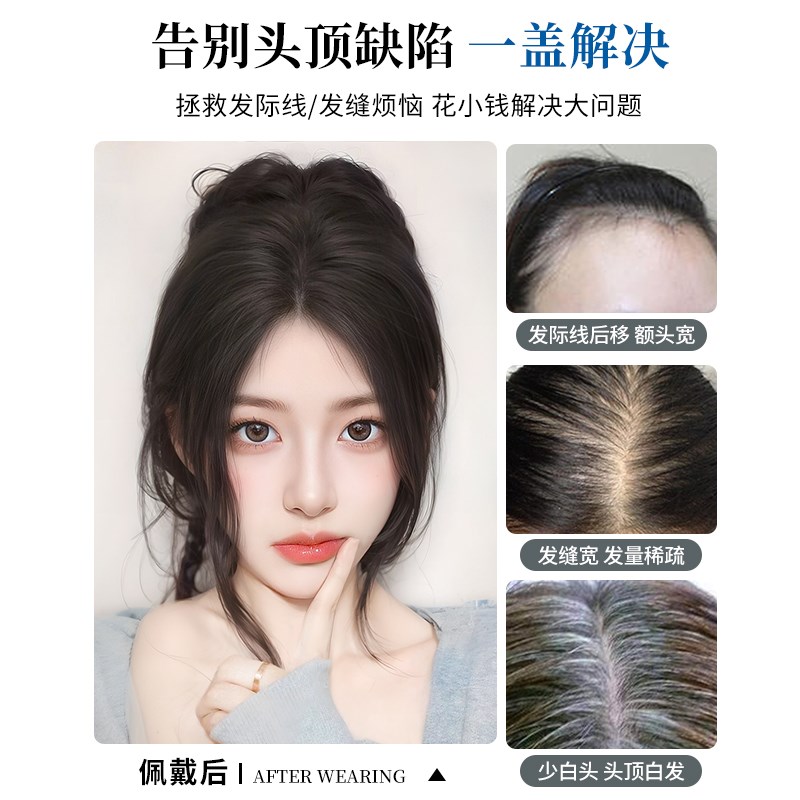 假发女片头顶补发增发量遮白发蓬松高颅顶全真人发无痕刘海假发片
