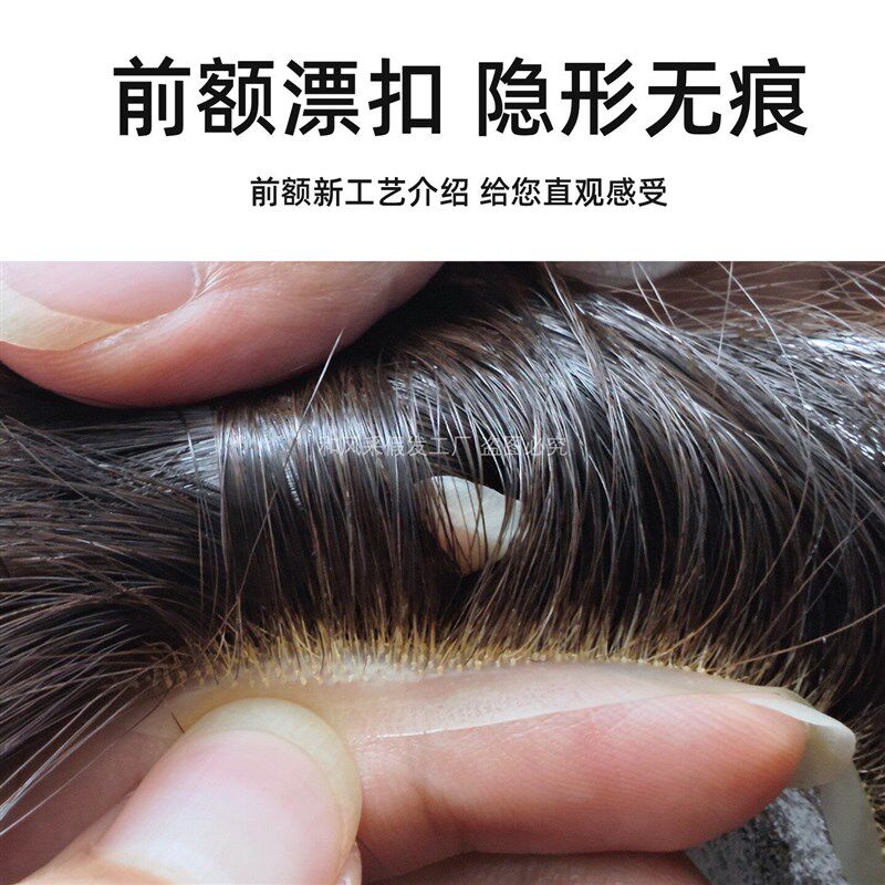 男士假发漂扣全递针仿真生物头皮头顶真发补发高端定制假发片韩版