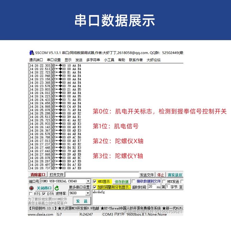 sEMG单导肌肉电传感器 加速度陀螺仪肌电臂环 肌电信号采集可开发
