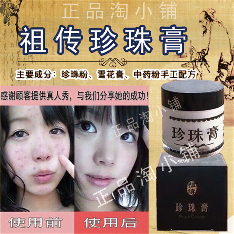 纯天然祖传祛豆膏 纯珍珠研磨珍珠膏祛斑霜 去痘 去痘印 美白