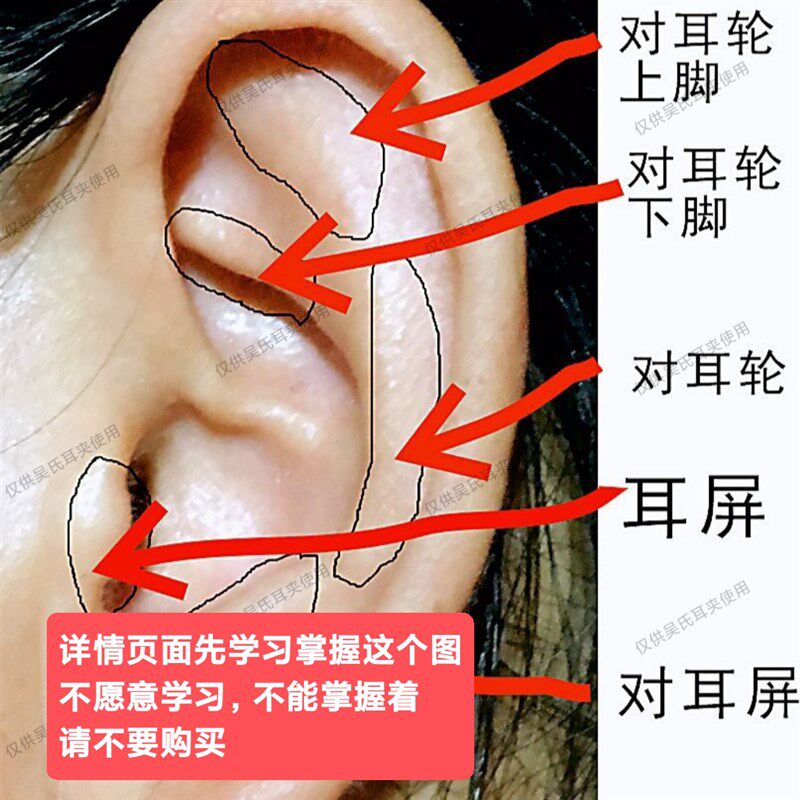 【32只装】穴位夹 全息夹 耳穴夹 耳贴 按摩 耳针吴氏耳夹保健夹