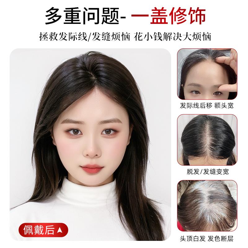 高颅顶假发女片头顶增发量蓬松神器遮白发自然逼真全真发刘海假发