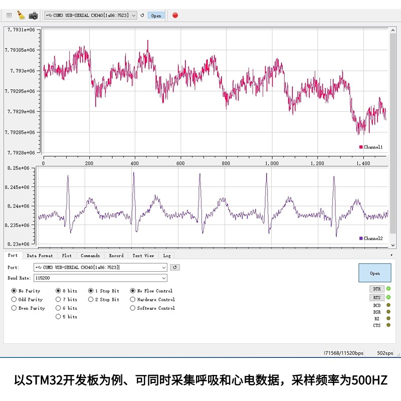 ADS1292R心电模块ECG心电采集板无线心电传输模块ADS1292R最小系