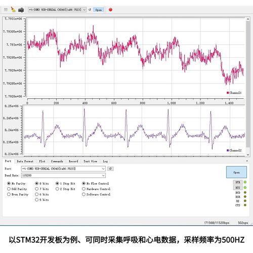 ADS1292R心电模块ECG心电采集板无线心电传输模块ADS1292R最小系