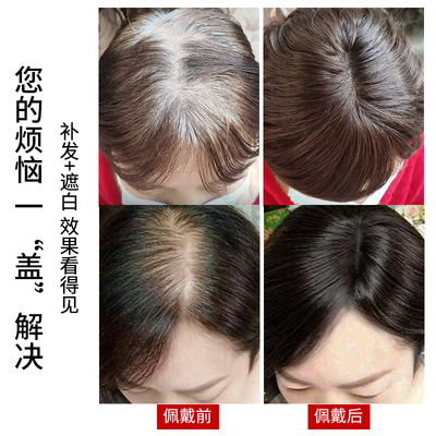 假发片头顶真发遮白发大面积短发蓬松增发量轻薄无痕头顶补发片女