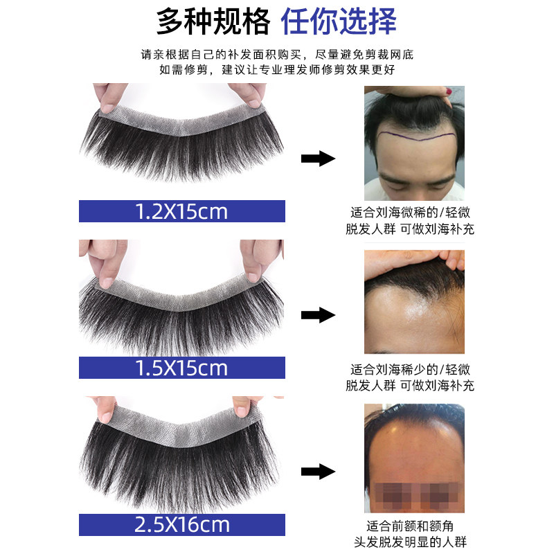 发际线假发贴精修款男士前额生物头皮补发片全真发短发额头假刘海