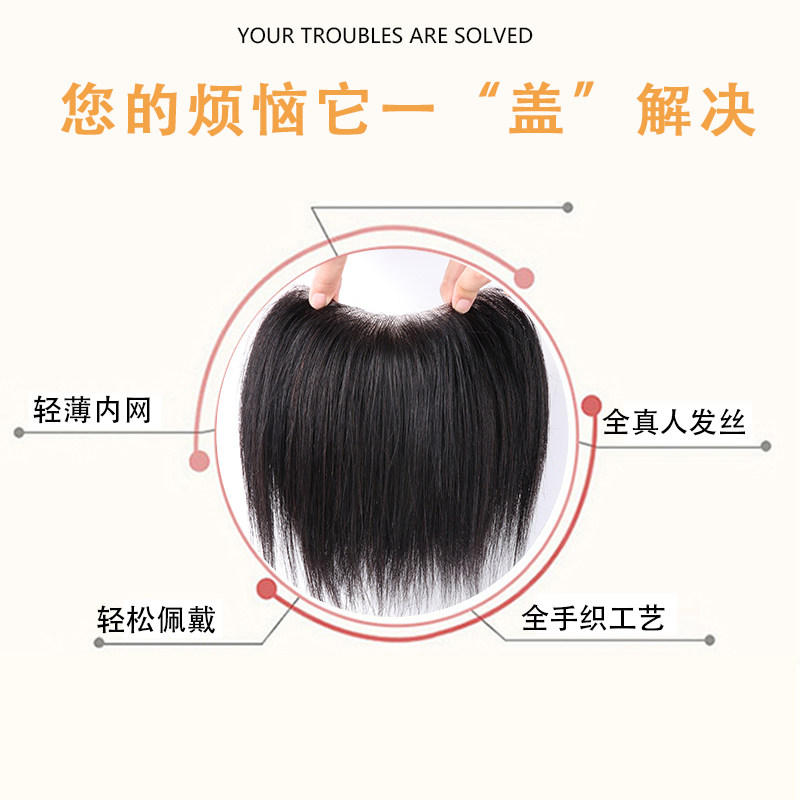 前额发际线假发贴M型假发片男士生物头皮补发高额头真发假刘海片