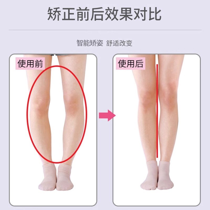 儿童婴儿o型腿x形腿矫正带宝宝腿外翻内八字脚非矫正器绑腿直腿带