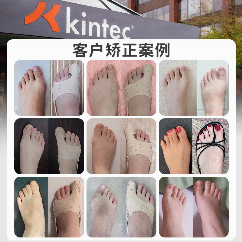 医院同款脚趾矫正器女拇指外翻儿童大脚骨纠正拇趾分离超薄可穿鞋